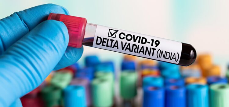 Contactos estrechos de variante Delta son PCR negativo