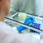 Gremios de la Salud plantean que laboratorios de la región no dan abasto para procesar las muestras de PCR diarias